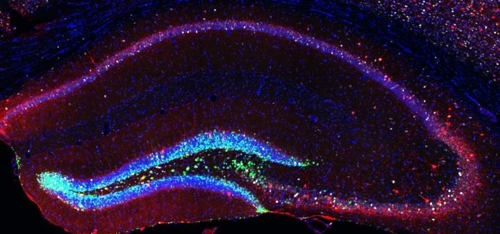 '뇌의 회춘' 가능할까…신경 줄기세포 자극 실험 성공