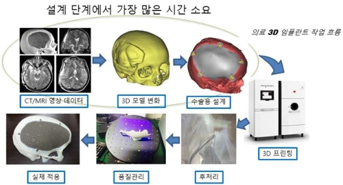 인공지능 기술로 환자별 맞춤형 의료 장비 만든다