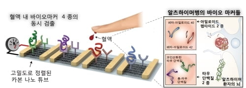 "피 한 방울로 알츠하이머 진단한다"…정확도 무려 88%