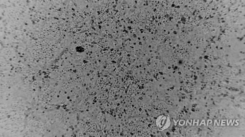 호주서 신종코로나바이러스 분리 성공…"진단·백신개발 기대"(종합)