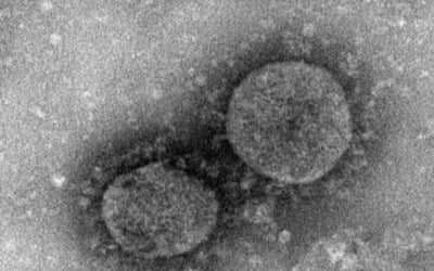 "홍콩서 '신종코로나' 백신 개발…임상시험은 1년여 걸려"