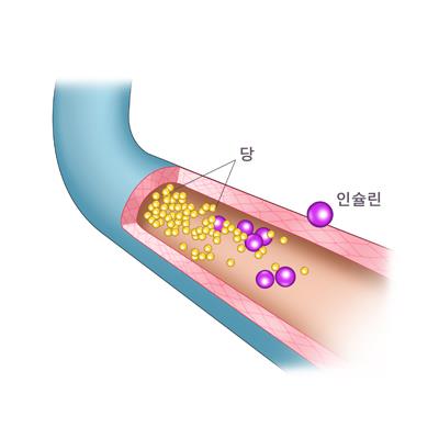 "약으로 인슐린 생산 베타세포 재생 가능'