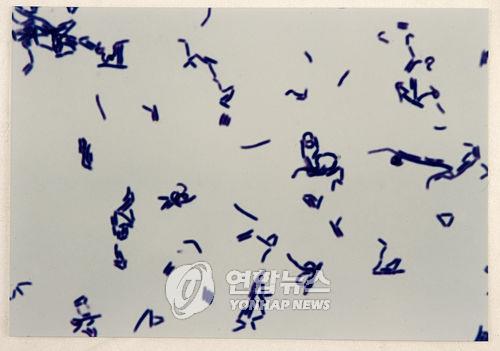 "장의 미생물 생태계, 성격 차이에도 영향 미친다"