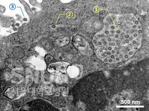 코로나19 현미경사진 국내 첫 공개…"바이러스에 변이 추정"