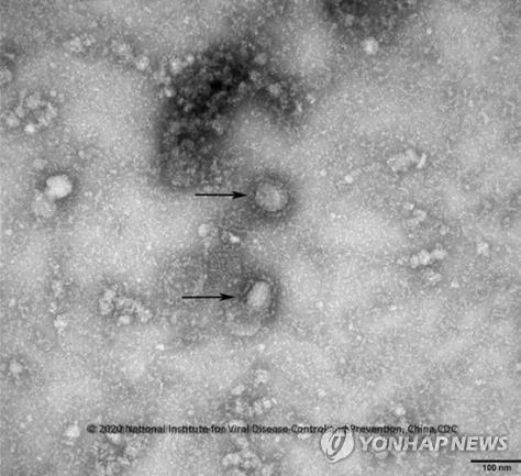 이란서 코로나19 감염자 첫 발생…"2명 확인"