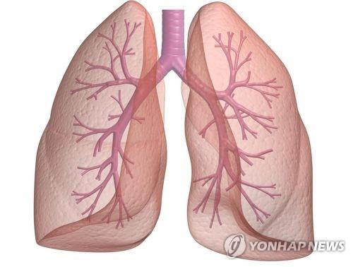 "체중 늘면 폐 기능 저하 가속"