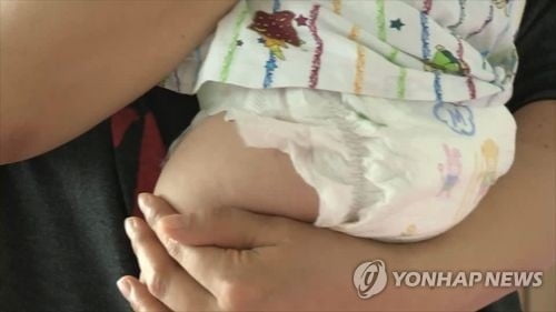 20대 미혼모 학대로 숨진 7개월 아기 `두개골 골절`…"던졌다"