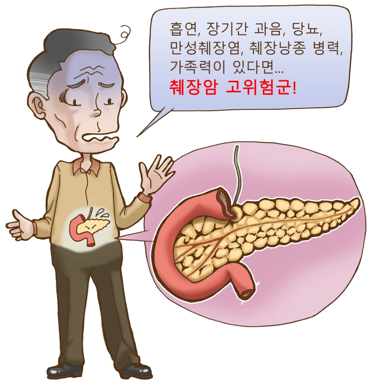 초기 발견 어려운 췌장암...체중 감소·잦은 복통시 증상 의심해야