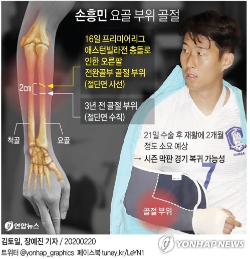 손흥민, 오른팔 골절 부위 수술…"핀으로 고정…주말까지 입원"