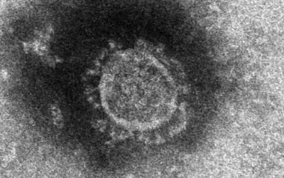 日전문가 "신종코로나, 잠복기 전염이 절반…치사율 0.3∼0.6%"