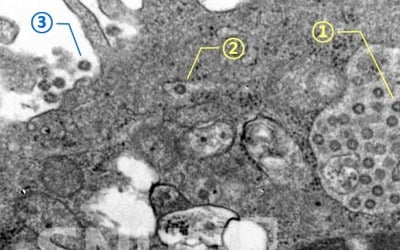 코로나19 현미경사진 국내 첫 공개…"바이러스에 변이 추정"