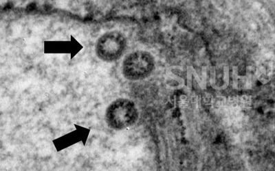 "코로나19 바이러스 대변서도 검출"…'에어로졸 감염' 근거되나