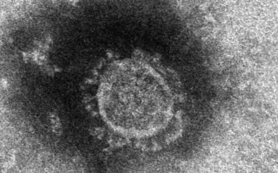 "日 신종플루·에볼라·HIV 3가지 약으로 코로나19 치료 시도"