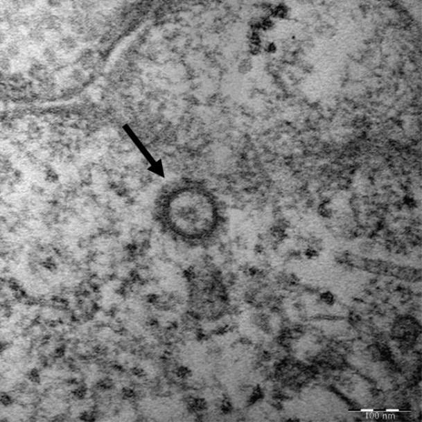 고해상 전자현미경으로 찍은 코로나19 바이러스 유전자의 모습. 연합뉴스