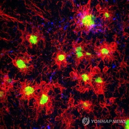 "알츠하이머 뇌의 비정상 RNA 편집, 뉴런 연접부 망가뜨린다"