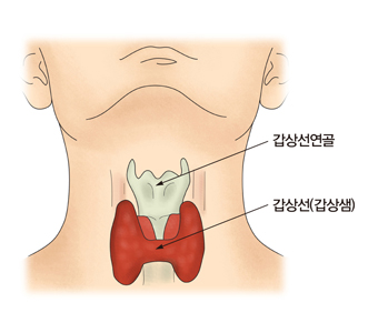 "갑상선 호르몬 치료, 노인들에 과처방되고 있다"