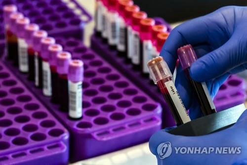 미국 CDC, 코로나19 항체검사 시작…무증상자 규모 밝혀질까