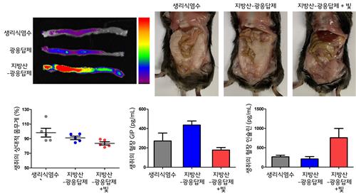 빛으로 호르몬 분비 억제해 비만·당뇨 치료한다