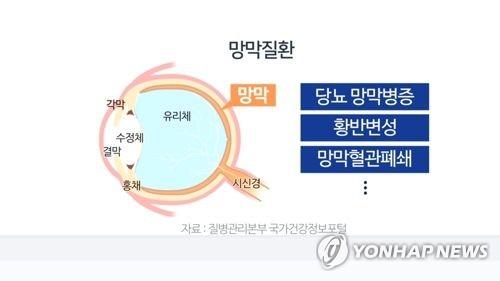 "피부세포로 직접 망막세포 만들었다"