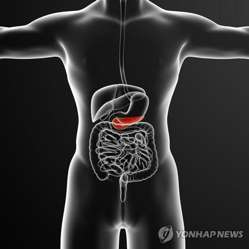 정확도 높은 췌장암 조기 진단 새 혈액검사법 개발