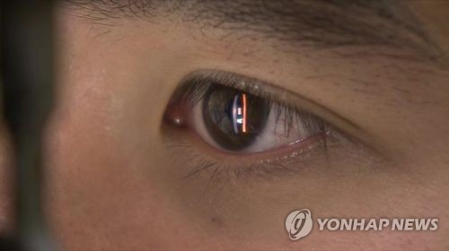 분당서울대병원, 망막사진으로 성별·나이 분석하는 기술 개발