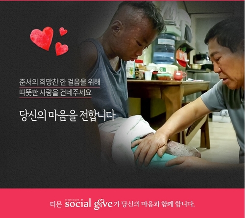 티몬, 7일까지 희귀 피부병 어린이 치료비 모금