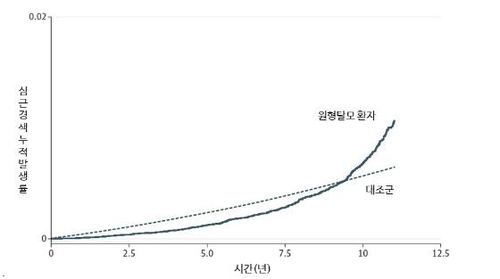 "원형탈모 환자, 심근경색 발병 위험 최대 4.5배"