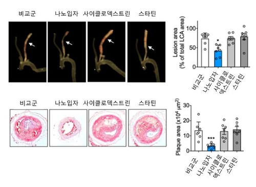 나노 약물 혈관에 투여해 콜레스테롤 덩어리 녹인다