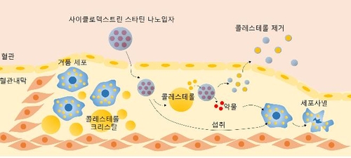 나노 약물 혈관에 투여해 콜레스테롤 덩어리 녹인다