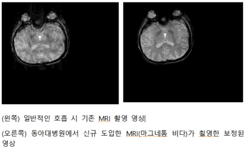 [부산소식] 동아대병원 첨단 MRI 장비 도입