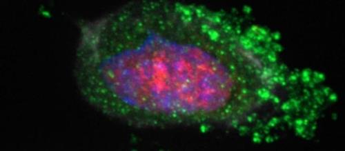 "마이크로 RNA가 항암 단백질 조절하는 기제 첫 발견"