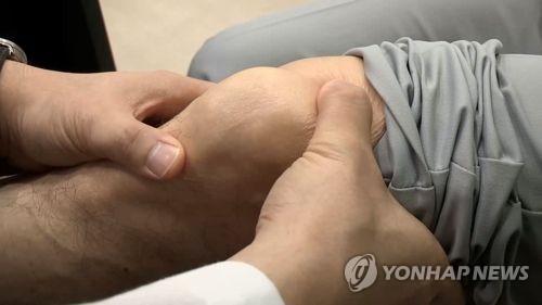 한국인만 된다는 '쪼그려 앉기' 편해도 무릎 건강엔 '치명적'