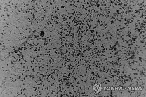 "코로나19 '면역증명서'는 나쁜 생각…더 많은 문제 초래 우려"