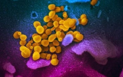 "코로나19, 男 고환 손상 가능성…정자 생산 영향 줄수도"