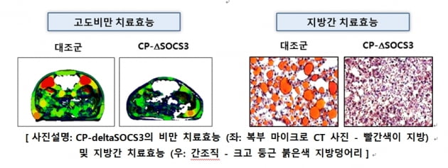 셀리버리, 美당뇨학회서 고도비만·2형 당뇨 치료제 연구 발표 선정