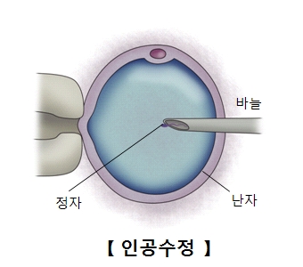 "체외수정 배아, 동결보존 기간 길수록 임신 성공률↓"