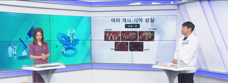 임플란트 실패, 골유착 실패가 원인