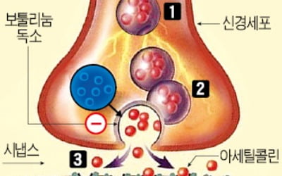 주름 펴주는 보툴리눔톡신, 근육 마비시켜 치료 효과