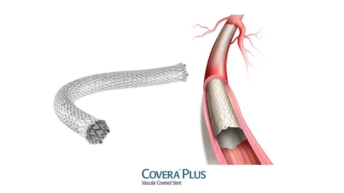 바드코리아, 말초혈관질환 치료용 인공혈관 출시