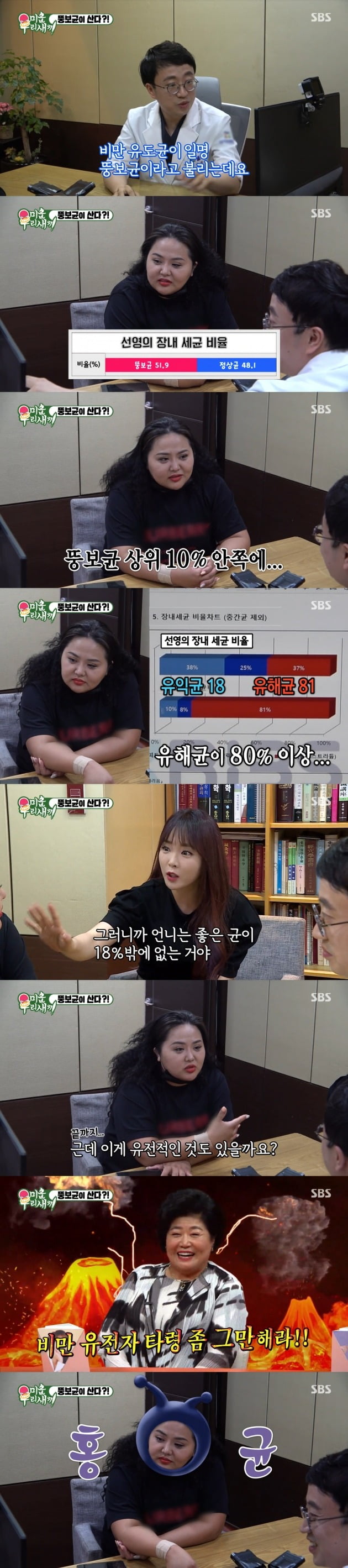 홍진영 언니 홍선영이 뚱보균 검사를 받았다. / 사진=SBS 방송 캡처
