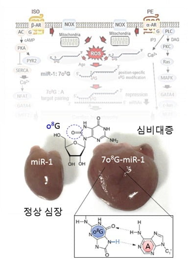 활성산소에 의해 8-옥소구아닌이라는 변형 염기가 발생하고, 이에 따른 염기배열 변화로 심장 비대증이 발생하는 메커니즘.