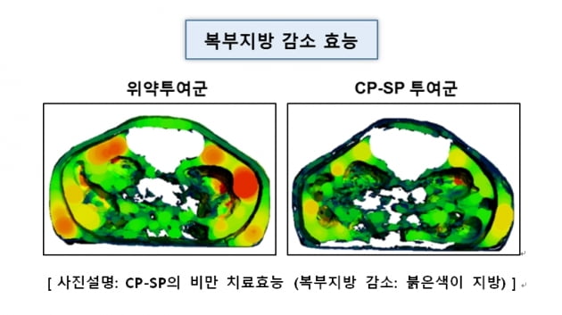 셀리버리, 美 CMO와 경구용 비만치료제 생산 계약