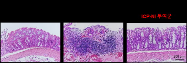 iCP-NI의 염증성장질환 치료효능. 궤양성대장염 동물모델에서 대장 점막 및 막하층이 뭉게진 반면(가운데), iCP-NI 투여군에서는 장 점막층 전체 구조가 정상조직 (왼쪽)과 유사하게 회복됐다.(오른쪽) 