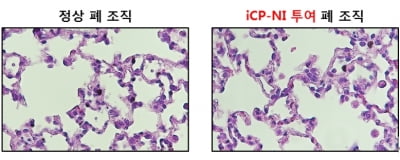 셀리버리, 코로나19 면역치료제 'iCP-NI' 독성시험에서 안전성 입증