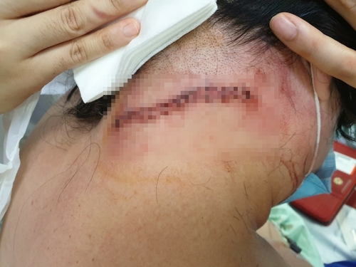 데이트폭력 신고 앙심 품고 전 연인에 흉기 휘두른 60대