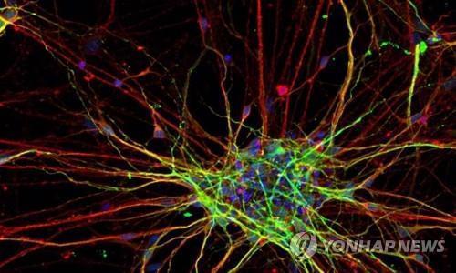 "꿈 많이 꾸는 '렘수면', 폭식 등 섭식 장애도 관여"