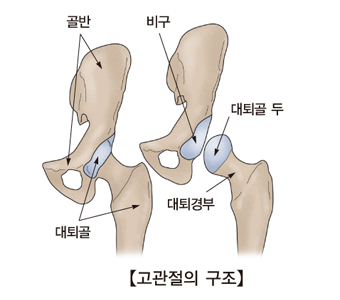 "금연, 고관절 골절 위험 90%↓"