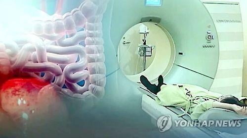 이스라엘 대학 연구팀 “초콜릿·베리·홍차가 대장암 위험 높인다”