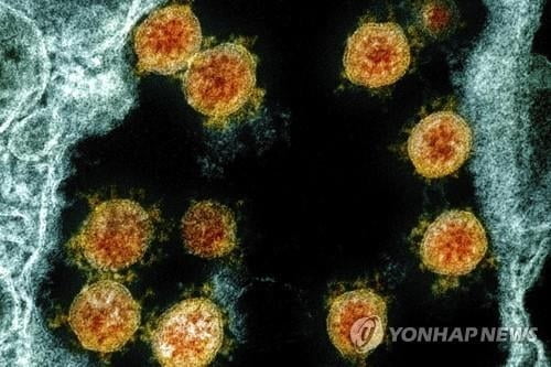 항체 면역력 의문…홍콩 이어 미국서 25세 남성 재감염