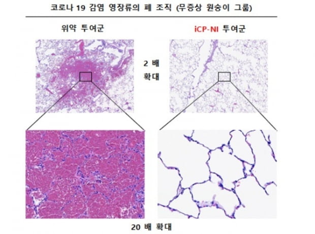 코로나19 감염 영장류 폐 조직. 자료제공=셀리버리